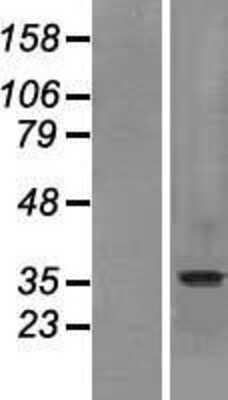 Western Blot: SLC10A2 Overexpression Lysate [NBP2-09028]