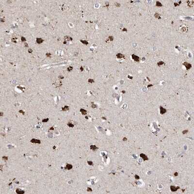Immunohistochemistry-Paraffin: SLC10A4 Antibody [NBP1-81134]