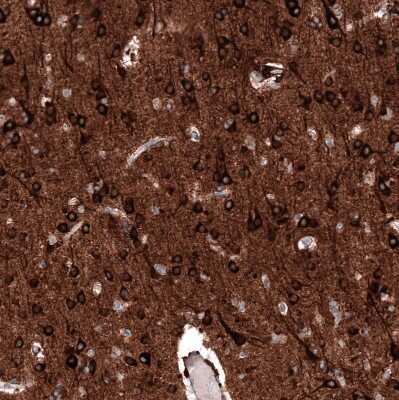 Immunohistochemistry-Paraffin: SLC10A5 Antibody [NBP1-85965]