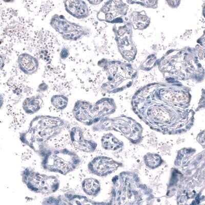 Immunohistochemistry-Paraffin: SLC10A5 Antibody [NBP1-85965]