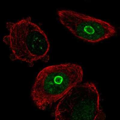 Immunocytochemistry/ Immunofluorescence: SLC10A7 Antibody [NBP2-58231]