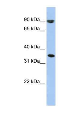 Western Blot: SLC10A7 Antibody [NBP1-59875]