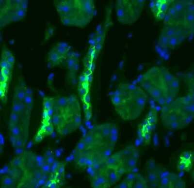 Immunohistochemistry: SLC12A3 Antibody [NBP1-44270]