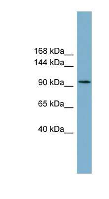 Western Blot: SLC12A3 Antibody [NBP1-59699]