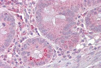 Immunohistochemistry-Paraffin: SLC13A2 Antibody [NBP1-62518]