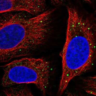 Immunocytochemistry/ Immunofluorescence: SLC14A1 Antibody [NBP2-58203]