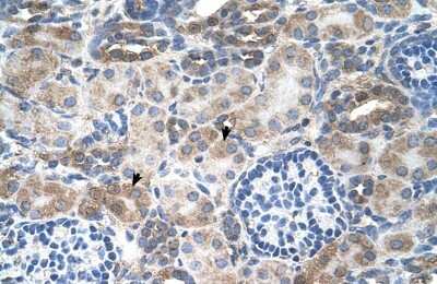 Immunohistochemistry-Paraffin: SLC14A1 Antibody [NBP1-60115]