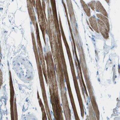 Immunohistochemistry-Paraffin: SLC16A10 Antibody [NBP1-80700]
