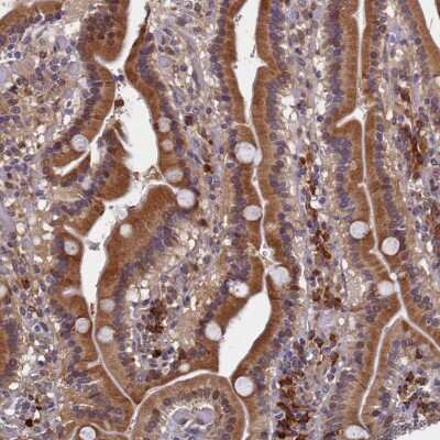 Immunohistochemistry-Paraffin: SLC16A14 Antibody [NBP1-83542]