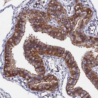 Immunohistochemistry-Paraffin: SLC16A14 Antibody [NBP1-83542]