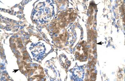 Immunohistochemistry-Paraffin: SLC17A2 Antibody [NBP1-60072]