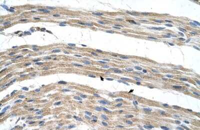 Immunohistochemistry-Paraffin: SLC17A4 Antibody [NBP1-59883]