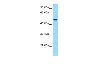 Western Blot: SLC19A2 Antibody [NBP2-88285]