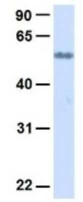 Western Blot: SLC19A3 Antibody [NBP1-69703]