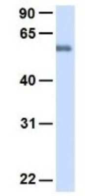 Western Blot: SLC19A3 Antibody [NBP1-69703]