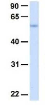 Western Blot: SLC19A3 Antibody [NBP1-69703]