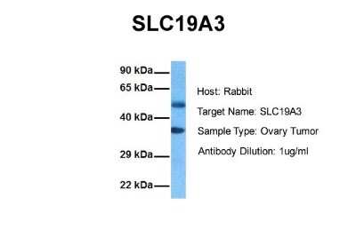 Western Blot: SLC19A3 Antibody [NBP1-69703]