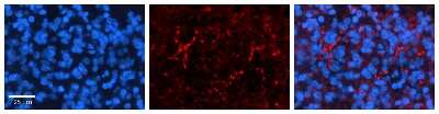 Immunohistochemistry: SLC1A4 Antibody [NBP1-60038]
