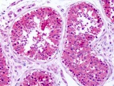 Immunohistochemistry-Paraffin: SLC1A4 Antibody - BSA Free [NBP1-44238]