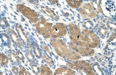 Immunohistochemistry: SLC1A5 Antibody [NBP1-59732]