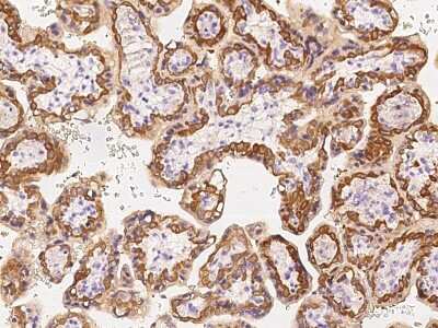 Immunohistochemistry-Paraffin: SLC1A5 Antibody [NBP2-97567]