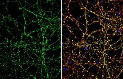Immunocytochemistry/ Immunofluorescence: SLC1A7 Antibody [NBP3-13363]