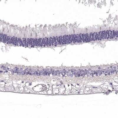 Immunohistochemistry-Paraffin: SLC1A7 Antibody [NBP2-13317]