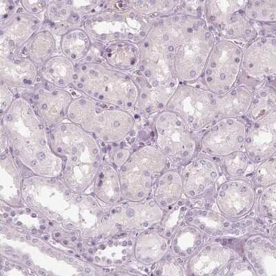 Immunohistochemistry-Paraffin: SLC1A7 Antibody [NBP2-13317]