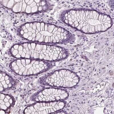 Immunohistochemistry-Paraffin: SLC1A7 Antibody [NBP2-13317]