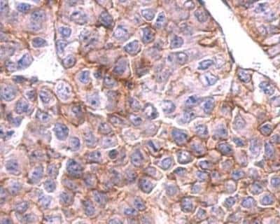 Immunohistochemistry-Paraffin: SLC20A1 Antibody [NBP1-32252]