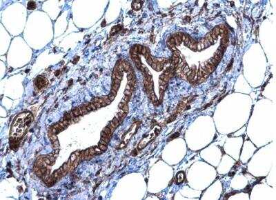 Immunohistochemistry-Paraffin: SLC20A1 Antibody [NBP1-32252]