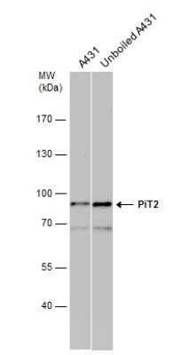 Western Blot: SLC20A2 Antibody [NBP1-32285]