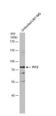 Western Blot: SLC20A2 Antibody [NBP1-32285]