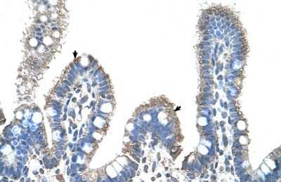 Immunohistochemistry-Paraffin: SLC22A1 Antibody [NBP1-59419]