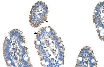 Immunohistochemistry-Paraffin: SLC22A1 Antibody [NBP1-59464]