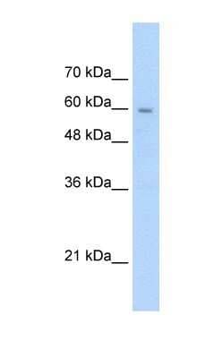 Western Blot: SLC22A1 Antibody [NBP1-59464]
