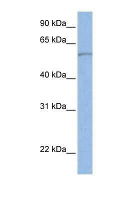 Western Blot: SLC22A11 Antibody [NBP1-69536]