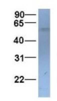 Western Blot: SLC22A11 Antibody [NBP1-69536]