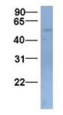 Western Blot: SLC22A11 Antibody [NBP1-69536]