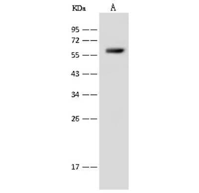 Western Blot: SLC22A12 Antibody [NBP2-99381]