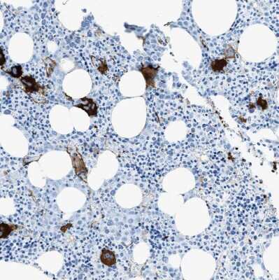 Immunohistochemistry-Paraffin: SLC22A15 Antibody [NBP1-84662]