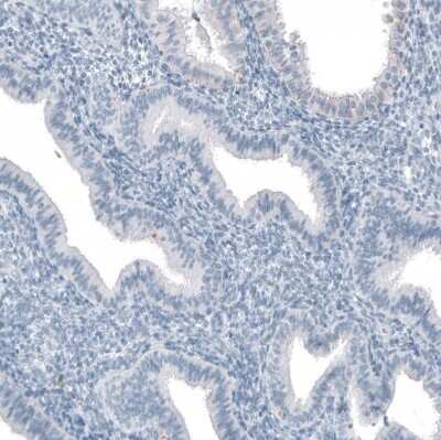 Immunohistochemistry-Paraffin: SLC22A2/OCT2 Antibody [NBP1-89417]