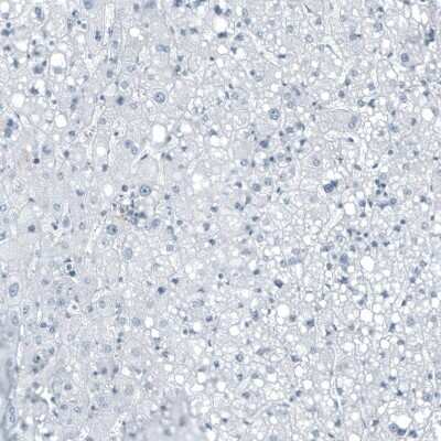Immunohistochemistry-Paraffin: SLC22A2/OCT2 Antibody [NBP1-89417]