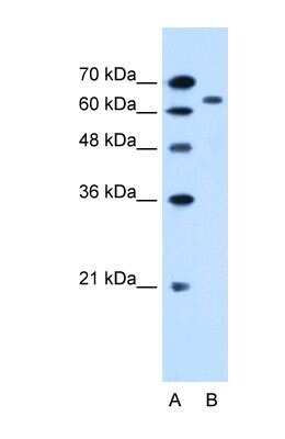 Western Blot: SLC22A3 Antibody [NBP1-69368]