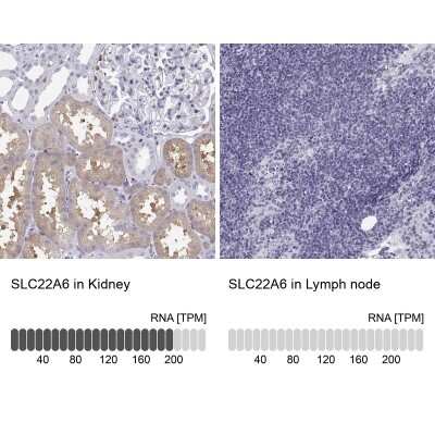 Immunohistochemistry-Paraffin: OAT1 Antibody [NBP2-62690]