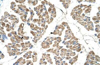 Immunohistochemistry-Paraffin: SLC22A7 Antibody [NBP1-62660]
