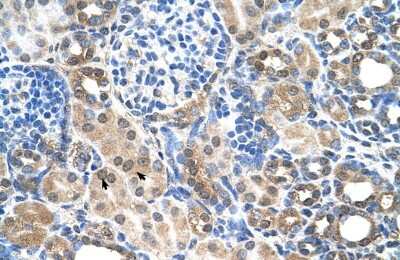 Immunohistochemistry-Paraffin: SLC22A7 Antibody [NBP1-69691]
