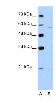 Western Blot: SLC22A7 Antibody [NBP1-62660]