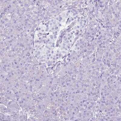 Immunohistochemistry-Paraffin: SLC23A1 Antibody [NBP2-13318]