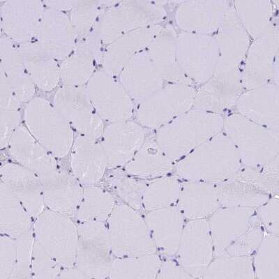 Immunohistochemistry-Paraffin: SLC24A6 Antibody [NBP1-83607]